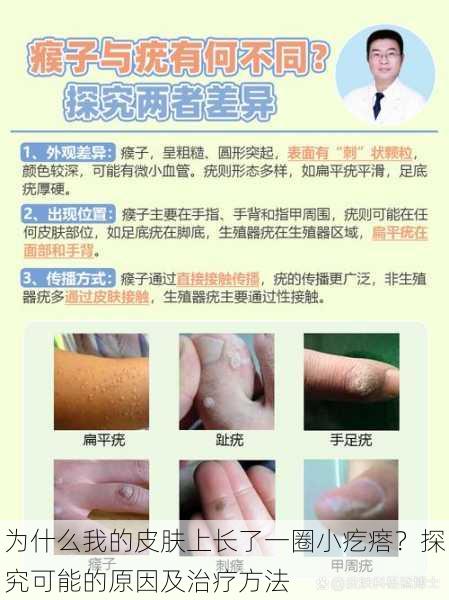 为什么我的皮肤上长了一圈小疙瘩?探究可能的原因及治疗方法