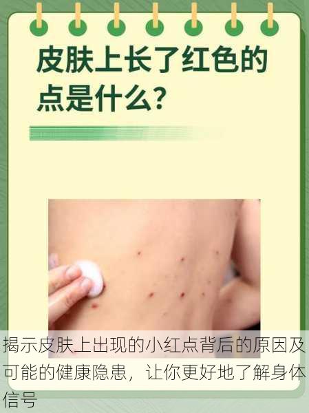 揭示皮肤上出现的小红点背后的原因及可能的健康隐患,让你更好地了解身体信号