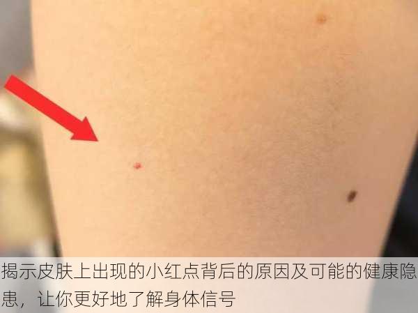 揭示皮肤上出现的小红点背后的原因及可能的健康隐患,让你更好地了解身体信号