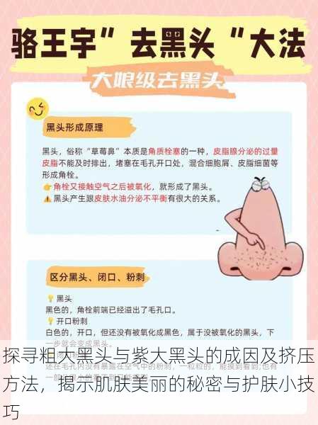 探寻粗大黑头与紫大黑头的成因及挤压方法,揭示肌肤美丽的秘密与护肤小技巧