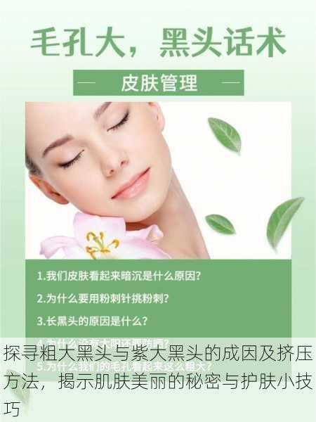 探寻粗大黑头与紫大黑头的成因及挤压方法,揭示肌肤美丽的秘密与护肤小技巧