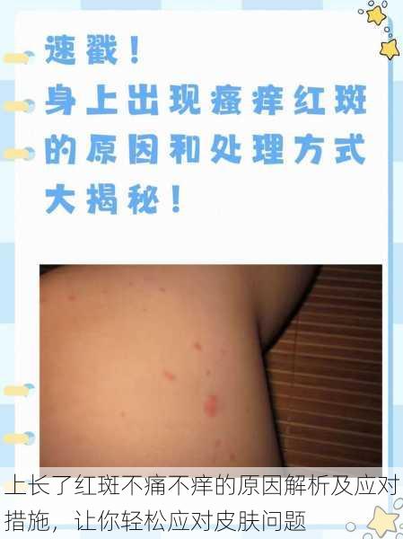 上长了红斑不痛不痒的原因解析及应对措施,让你轻松应对皮肤问题